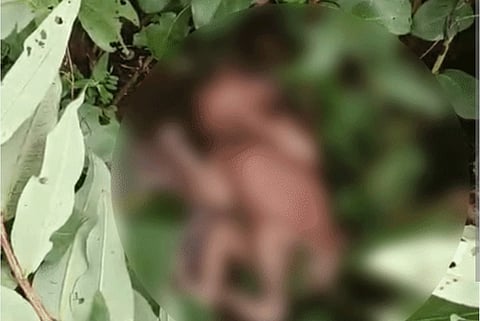 MP: रायसेन के जंगल में नवजात बच्ची मिली, चीटियां काटती रहीं, 3-4 घंटे बारिश के पानी में पड़ी रही