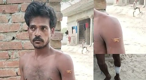 Mukesh sustained injuries to his hands and legs after allegedly being attacked with shovel.