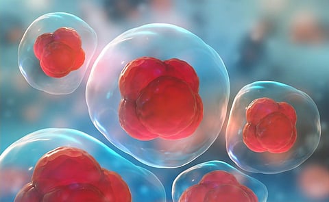 Stem Cell Therapy Offers New Hope for Hirschsprung's Disease Patients
