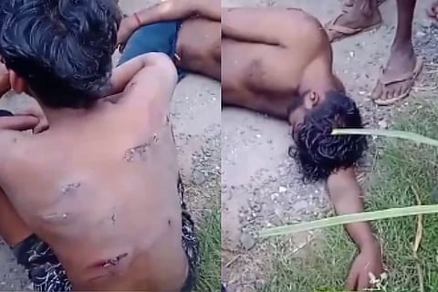 Two Dalit youths allege assault, human rights violation in Tamil Nadu’s Erode
