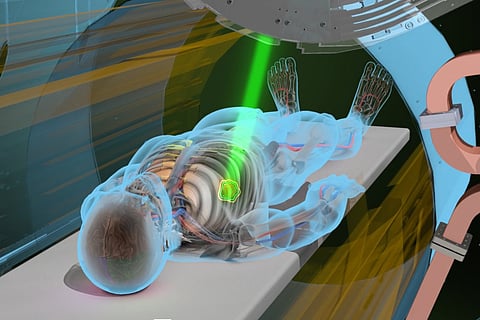 Modern radiotherapy is revolutionising cancer treatment in India