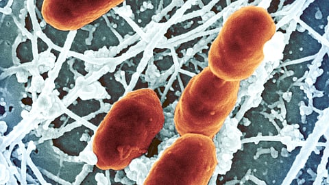 Rickettsia typhi Bacteria 
