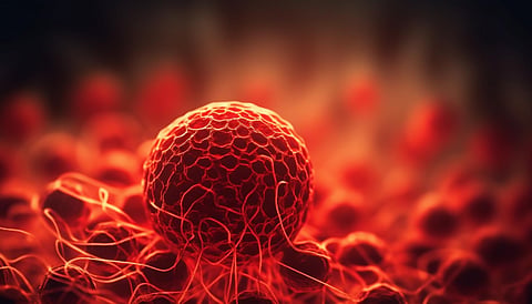 Understanding Bladder Tumors: Symptoms, Risks, and Advances in Treatment