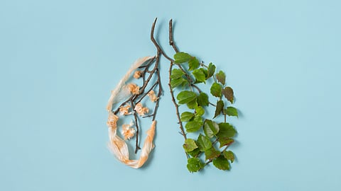Early Detection, Lifesaving Results: The Importance of Lung Cancer Screening