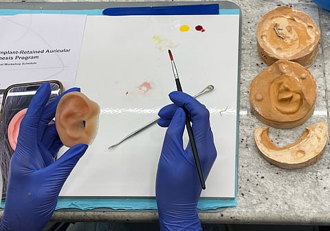 How facial prosthetics are helping patients recover after trauma and severe injuries