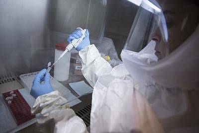 Andhra Pradesh on alert over Ebola virus