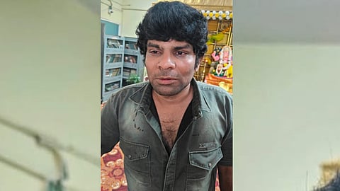 Bengaluru man throws acid on wife, brutally attacks her with knife in full public view