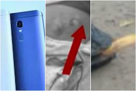This is scary: Biker scorched as Redmi Note 4 bursts into flames in his pocket