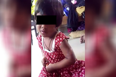 'Daddy burnt me': Tortured by mother and her partner, 4-year-old rescued in Hyd   