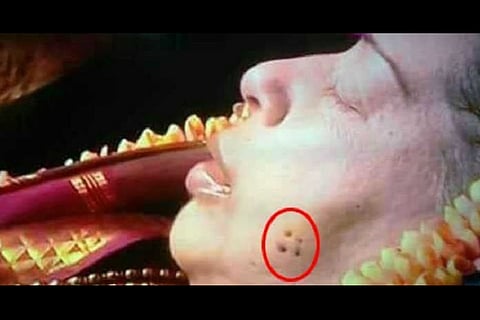 What were the four dots on Jayalalithaa's cheek when she died? Doctors answer