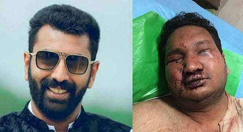 No bail for Nalapad: Karnataka HC rejects his plea in Vidvat assault case