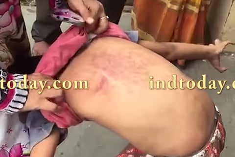 Hyderabad Class II student allegedly thrashed by school principal mercilessly for failing to read  