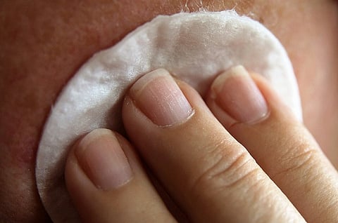 Common lumps and bumps on and under the skin: what are they?