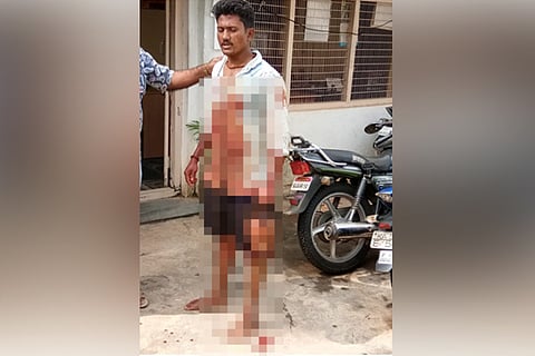 Third beheading in K'taka in a month: Man walks into police station with severed head