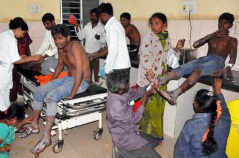 70 people sustain burns in Tumakuru fire-walking ritual on Mahashivratri