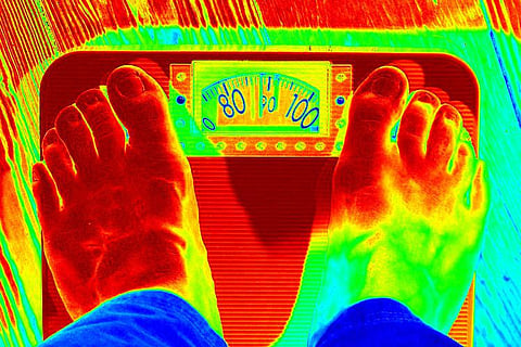Singer SPB swears by bariatric surgery, but is the weight-loss procedure suited for all?