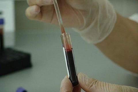 Explainer: Bangladesh strain of Nipah virus confirmed, what this means for Kerala  
