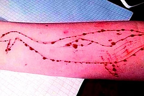 Puducherry University student commits suicide, Blue Whale link suspected
