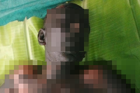 Person with disability burnt alive in Thiruvarur following argument over drinking in public
