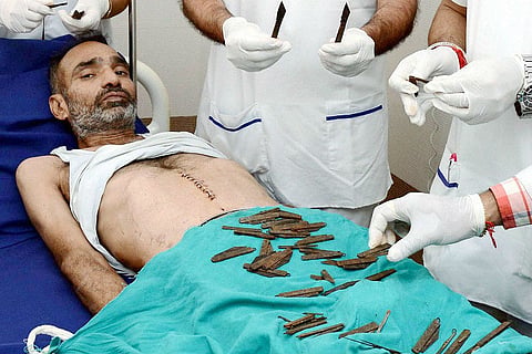 40 knives removed from stomach of a Punjab policeman