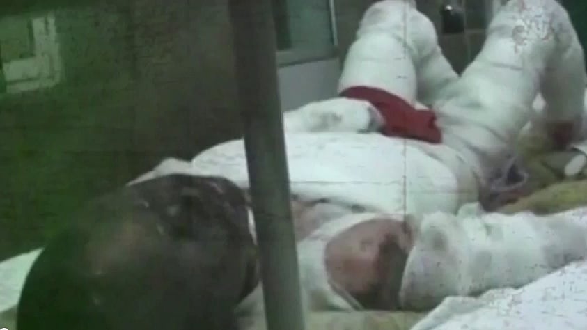 Man charred for reporting daughter’s molestion to police in Unnao. (Photo: ANI screengrab)