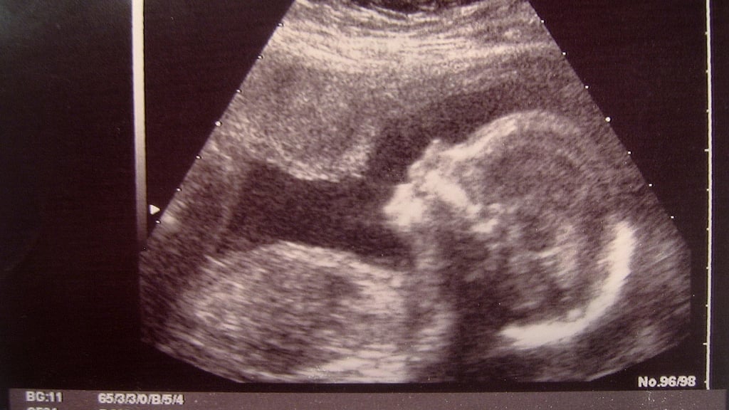 Should the abortion laws be amended to deal with pregnant rape victims who are minors? (Photo: iStock)