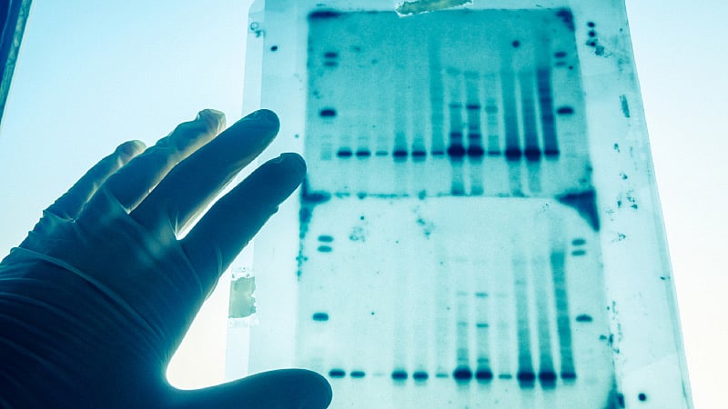 Representational picture of DNA testing. (Photo: iStockphoto)
