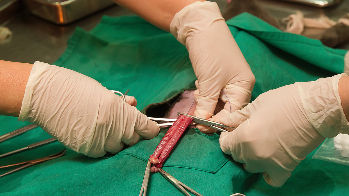 Madras High Court decided on castration as a one-word solution for tackling child sex crimes. (Photo: iStockphoto)