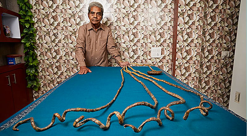 He nailed it! Meet the man who hasn’t cut his nails for over six decades and holds the title for the longest fingernails in one hand ever. (Photo courtesy: Guinness Book of World Records)