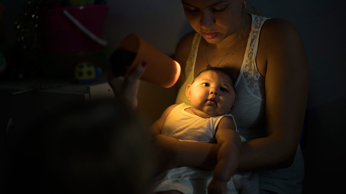 A baby born with microcephaly – stunted brain growth triggered by the Zika virus in Brazil. (Photo: AP)