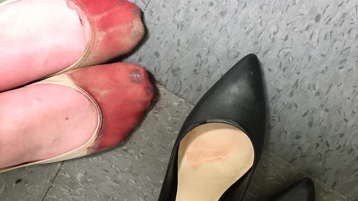 The post covers how the waitress was forced to wear high heels despite her bleeding feet and broken nail. (Photo Courtesy:<a href="https://www.facebook.com/photo.php?fbid=10156847226410162&set=a.10150598246885162.684577.524255161&type=3&theater"> Facebook/Nicola Gavins</a>)