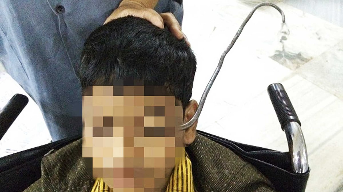 The patient, Md Baba Qureshi, was conscious and his eyeball was intact when he was brought to the hospital. (Photo: The News Minute)
