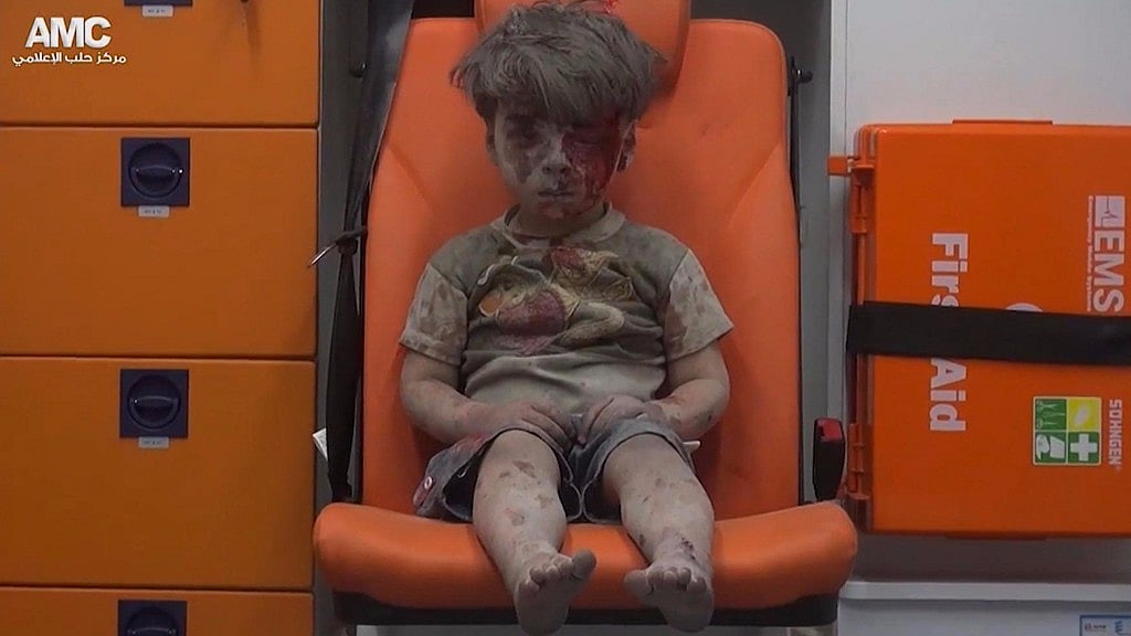 The media was ushered in for an extended photo session after the four-year-old boy was pulled out of rubble following a Russian airstrike. (Photo: AP)
