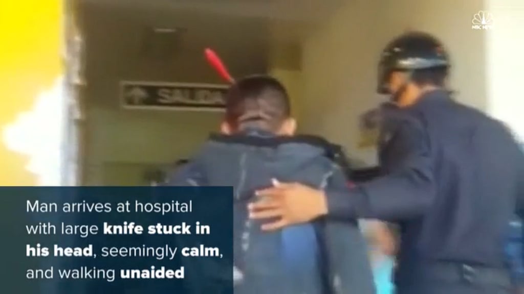 

Despite the attack, Carlos Campos appeared to be in a stable condition and did not need much assistance from the authorities (Photo Courtesy: NBC News)