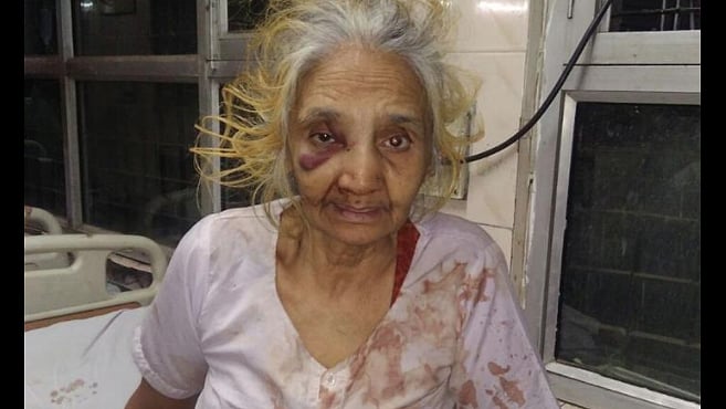 What a horrific incident. (Photo Courtesy: Facebook/<a href="https://www.facebook.com/EngineerKundanSrivastava">Kundan Srivastava</a>)