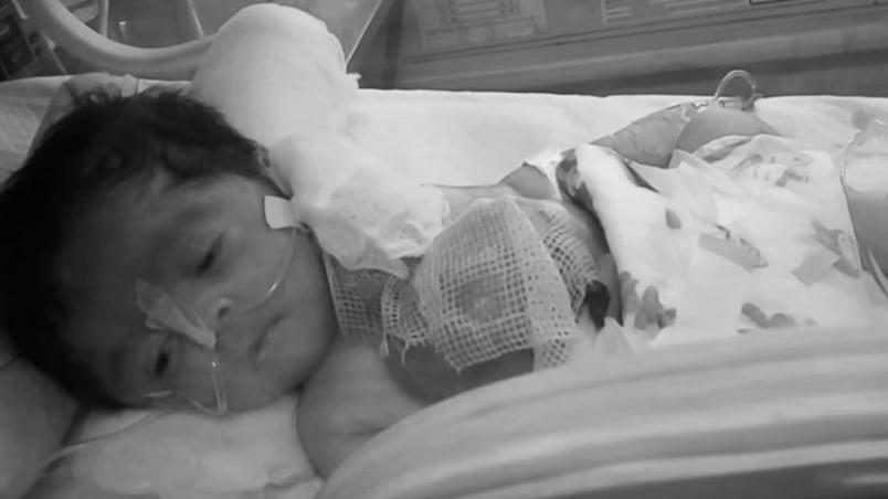Baby in Pakistan born with heart outside her body (Photo Courtesy - Caters/Alter By the Quint)