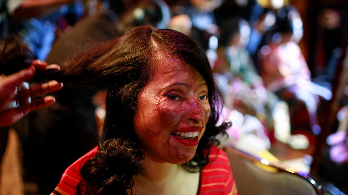 A Bangladeshi acid attack survivor getting her make-up done during the event ‘Beauty Redefined’ in Dhaka, Bangladesh. (Photo: AP)