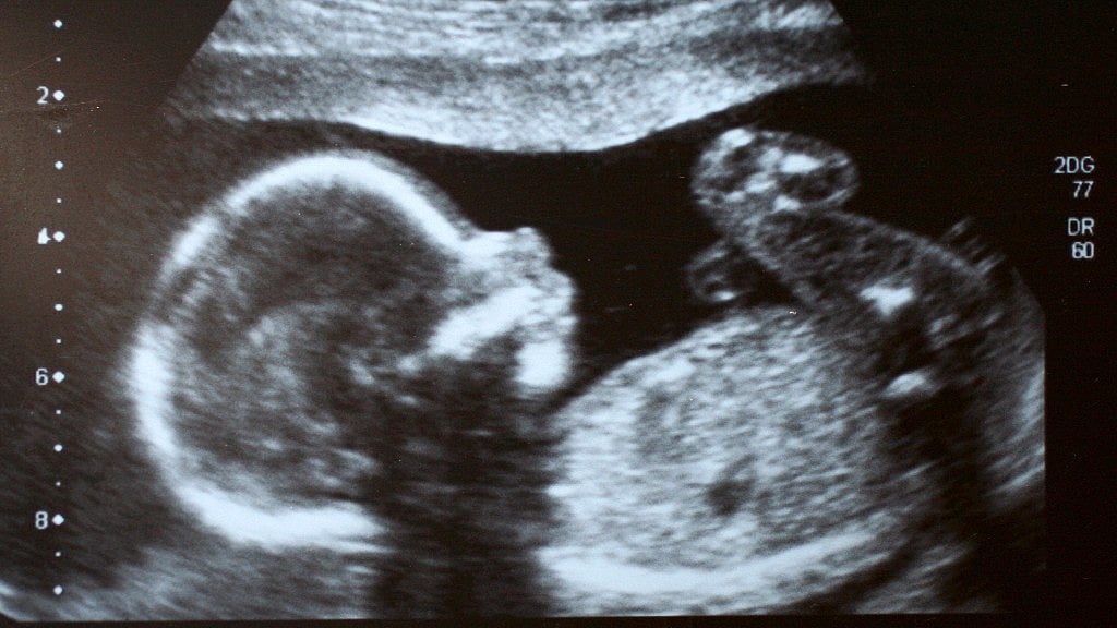 Image used for representation.