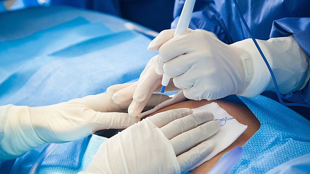 However, the experts warn that the use of robots in surgery could be controversial.