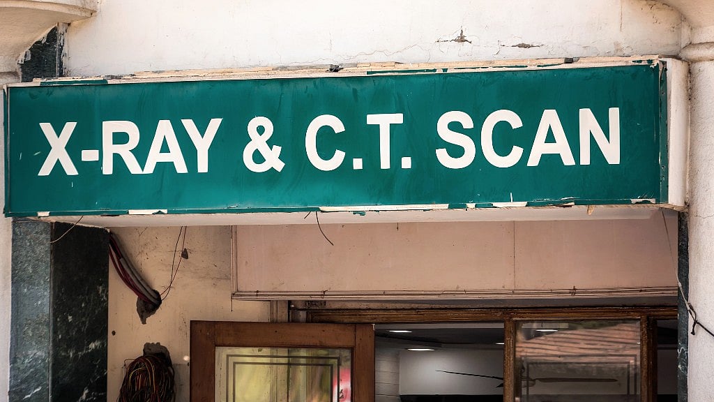 The cost of a CT scan is Rs 1,350 and Santosh had only Rs 1,300. 