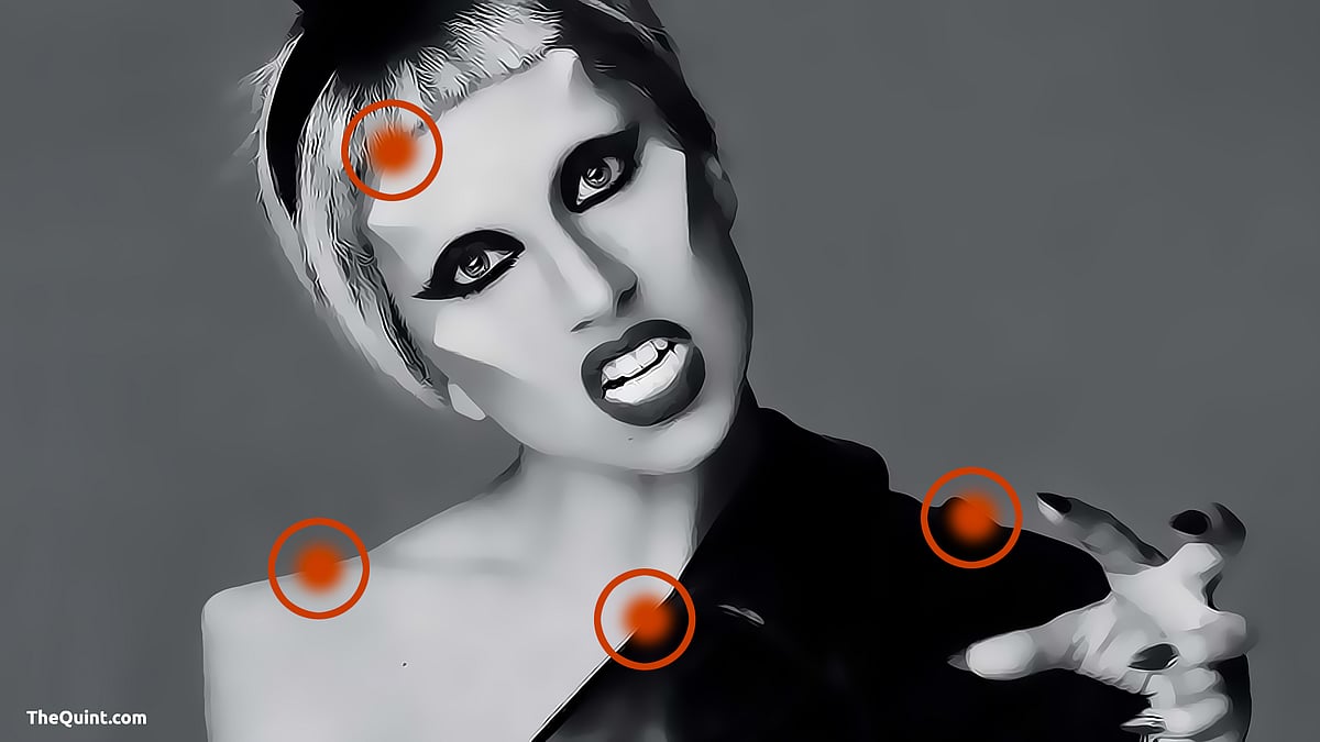 Lady Gaga reveals her illness on twitter. She cancelled the European leg of her world tour because of Fibromyalgia.
