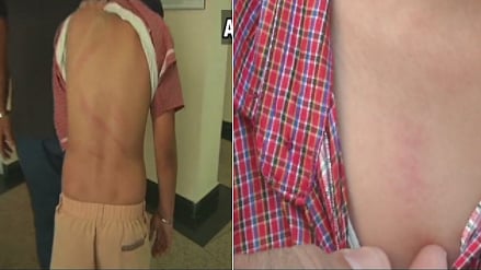 The police have received the medical report of the child and filed a complaint to take action in the matter.