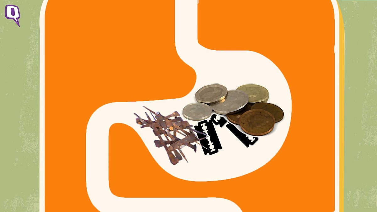 Bizarre metal items like coins, nails and blades found in a 35-year-old man’s stomach.