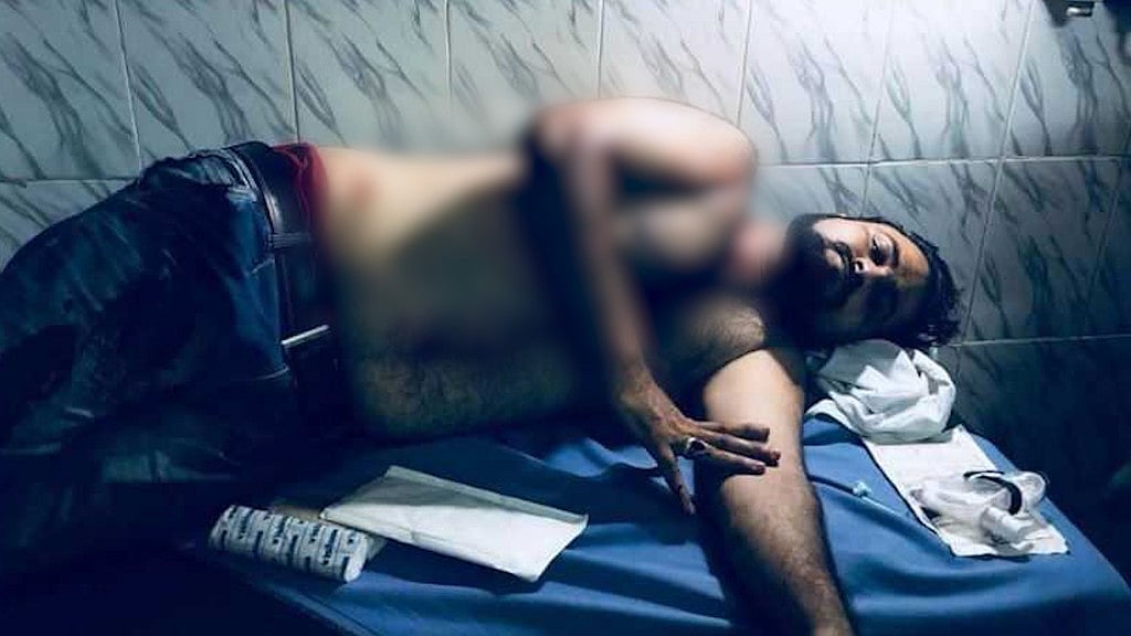 Dr Kafeel Khan’s younger brother Kashif Jameel was reportedly shot at in Gorakhpur, late Sunday (10 June) night. &nbsp;