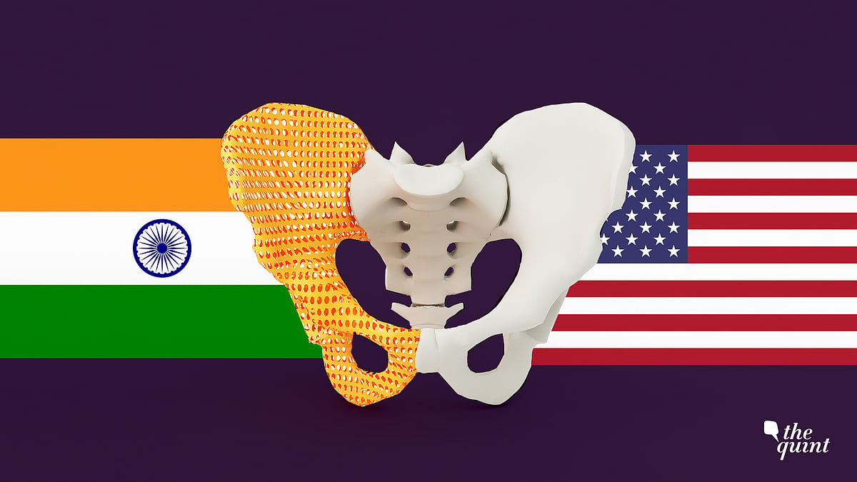 Johnson & Johnson hip implants case necessitates that India must begin the process of regulatory reforms.