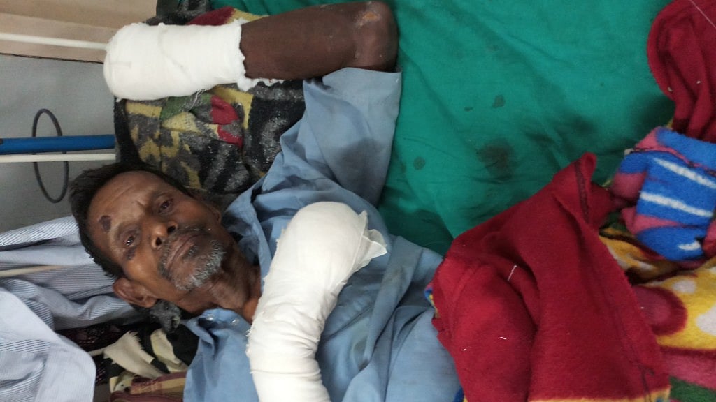 The 73-year-old had all his fingers chopped off by his younger son.