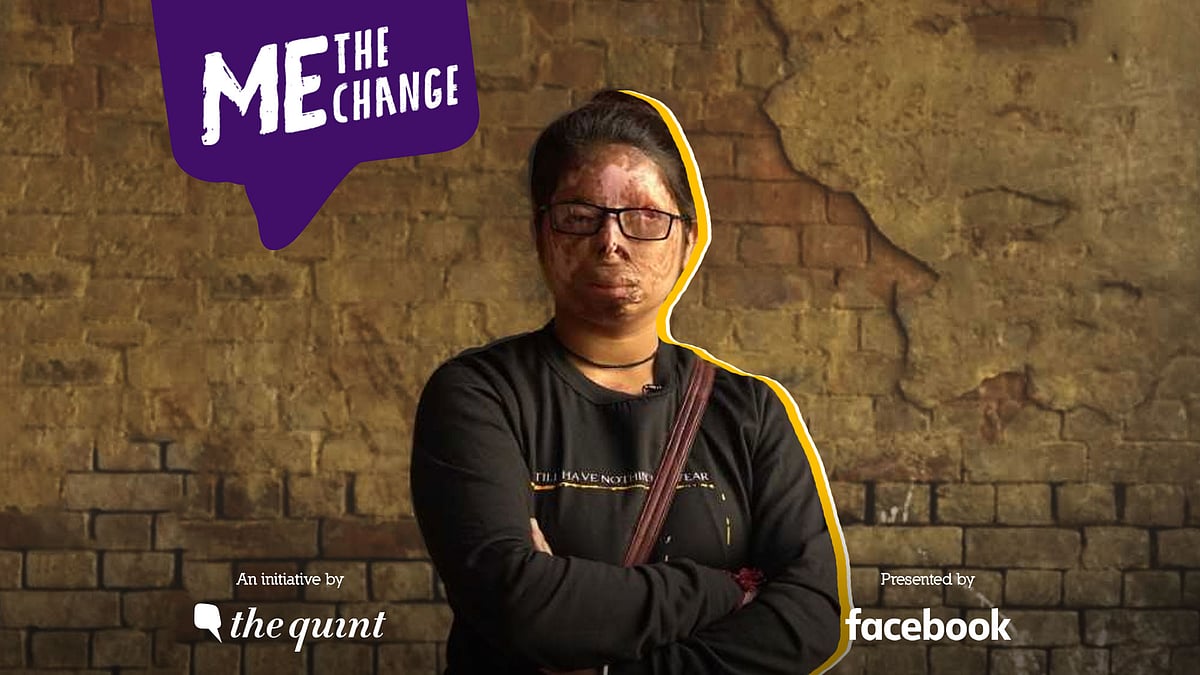 Anshu Rajput is a 21-year-old acid attack survivor. 