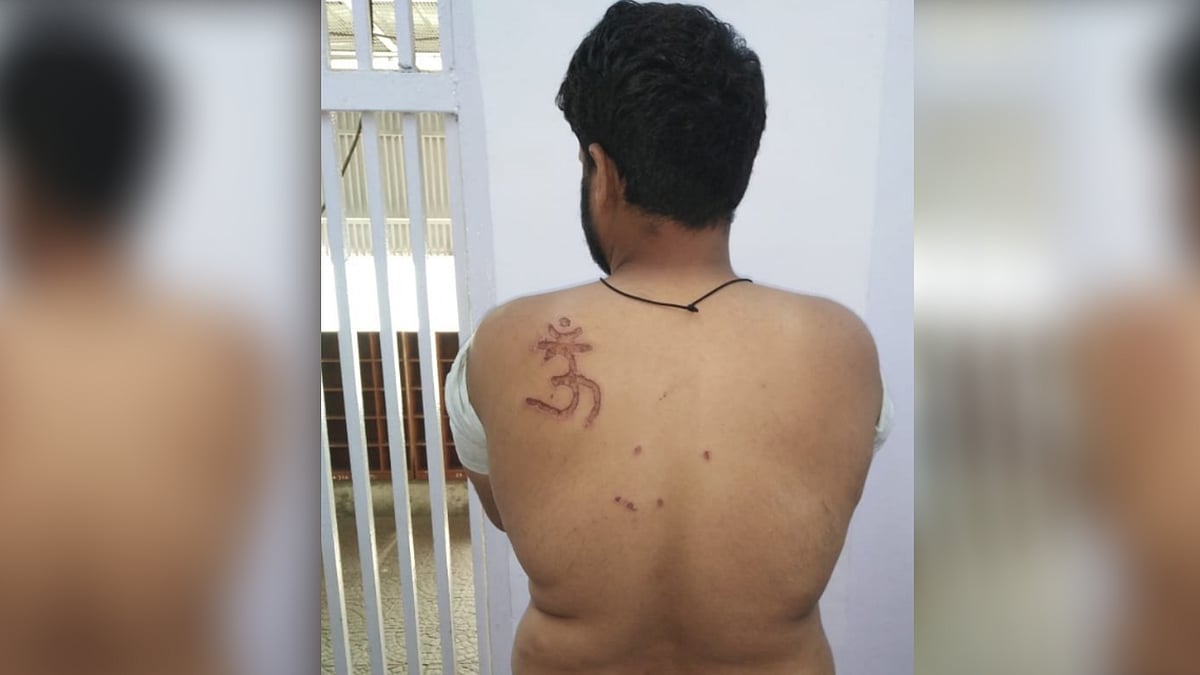 Tihar Prisoner, Nabir had alleged that the jail Superintendent subjected him to inhuman treatment, deprived him of food and branded the ‘Om’ symbol on his shoulder.