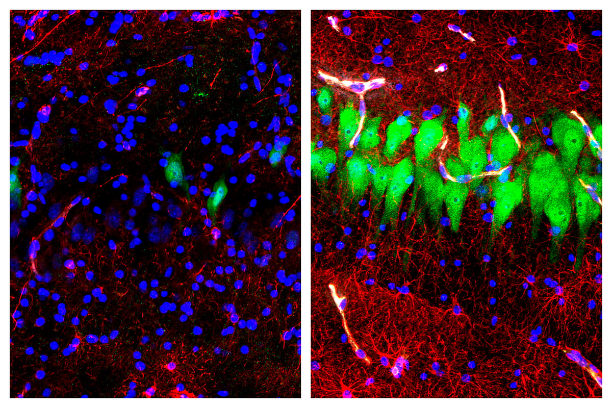 Neurons in a dead brain (L), Neurons after being treated (R).