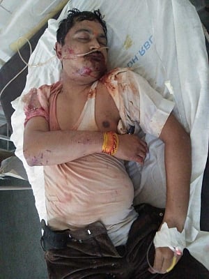 Lucknow: Unnao rape survivor
